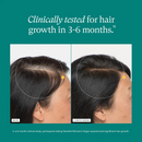 Nutrafol Women Hair Growth Supplement 18-44 Thicker Stronger Hair 120 Capsules